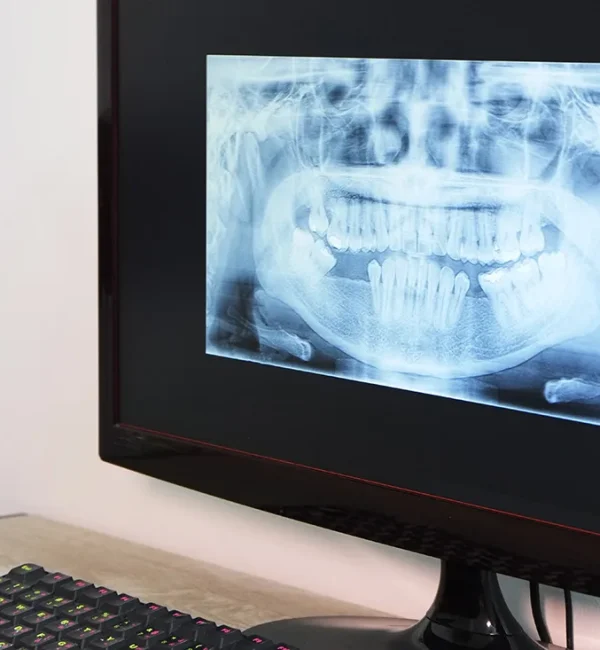 69de67cb47c9a80a7f42ed4a_service-thumbnail-digital-xrays