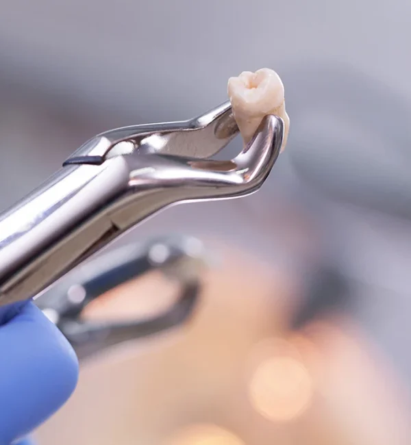 69de67cd47c9a80a7f42edd8_service-thumbnail-extractions
