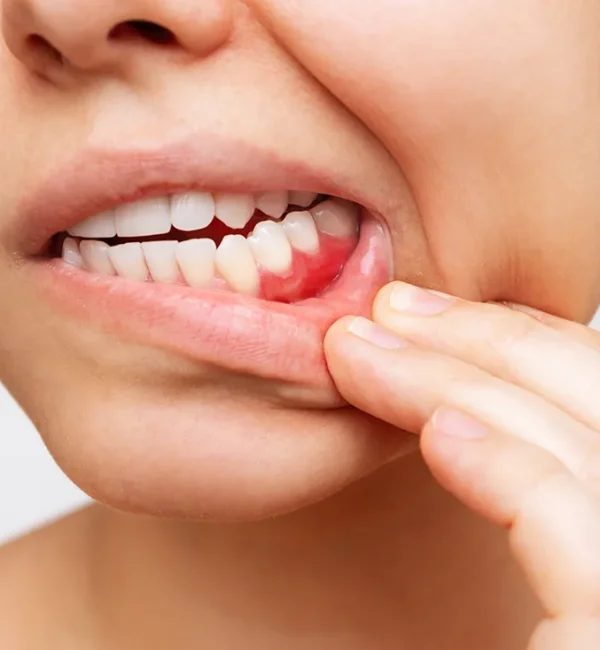 69de67f647c9a80a7f42f9f6_service-thumbnail-periodontal-care
